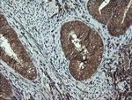 DOK7 Antibody in Immunohistochemistry (Paraffin) (IHC (P))