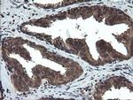 DOK7 Antibody in Immunohistochemistry (Paraffin) (IHC (P))