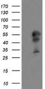 DOK7 Antibody in Western Blot (WB)