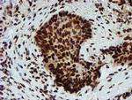 PADI4 Antibody in Immunohistochemistry (Paraffin) (IHC (P))