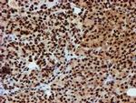 PADI4 Antibody in Immunohistochemistry (Paraffin) (IHC (P))