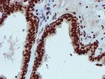 PADI4 Antibody in Immunohistochemistry (Paraffin) (IHC (P))