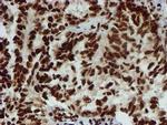 PADI4 Antibody in Immunohistochemistry (Paraffin) (IHC (P))