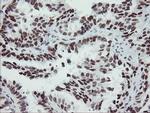 SENP2 Antibody in Immunohistochemistry (Paraffin) (IHC (P))