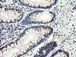 ACBD3 Antibody in Immunohistochemistry (Paraffin) (IHC (P))