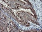 DPH2 Antibody in Immunohistochemistry (Paraffin) (IHC (P))