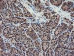 DPH2 Antibody in Immunohistochemistry (Paraffin) (IHC (P))