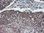 DPH2 Antibody in Immunohistochemistry (Paraffin) (IHC (P))