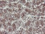 DPH2 Antibody in Immunohistochemistry (Paraffin) (IHC (P))