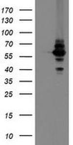 DPH2 Antibody in Western Blot (WB)