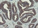 DPH2 Antibody in Immunohistochemistry (Paraffin) (IHC (P))