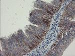 DPH2 Antibody in Immunohistochemistry (Paraffin) (IHC (P))