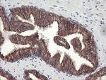 DPH2 Antibody in Immunohistochemistry (Paraffin) (IHC (P))