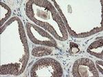 DPH2 Antibody in Immunohistochemistry (Paraffin) (IHC (P))