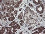 DPH2 Antibody in Immunohistochemistry (Paraffin) (IHC (P))