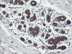 DPH2 Antibody in Immunohistochemistry (Paraffin) (IHC (P))