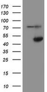 ADH7 Antibody in Western Blot (WB)