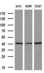 ADH7 Antibody in Western Blot (WB)