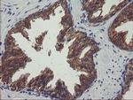 VBP1 Antibody in Immunohistochemistry (Paraffin) (IHC (P))