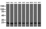 VBP1 Antibody in Western Blot (WB)