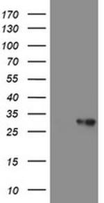 VBP1 Antibody in Western Blot (WB)