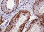 PADI4 Antibody in Immunohistochemistry (Paraffin) (IHC (P))