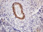 PADI4 Antibody in Immunohistochemistry (Paraffin) (IHC (P))