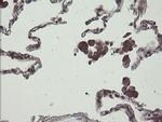 COMMD1 Antibody in Immunohistochemistry (Paraffin) (IHC (P))