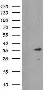 UBE2J1 Antibody in Western Blot (WB)