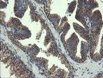 UBE2J1 Antibody in Immunohistochemistry (Paraffin) (IHC (P))