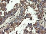 UBE2J1 Antibody in Immunohistochemistry (Paraffin) (IHC (P))