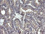 ERp57 Antibody in Immunohistochemistry (Paraffin) (IHC (P))