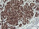 RFC2 Antibody in Immunohistochemistry (Paraffin) (IHC (P))