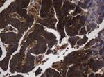 ASGR2 Antibody in Immunohistochemistry (Paraffin) (IHC (P))