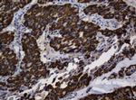 ASGR2 Antibody in Immunohistochemistry (Paraffin) (IHC (P))