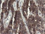 eIF5A2 Antibody in Immunohistochemistry (Paraffin) (IHC (P))