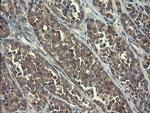 POLR3C Antibody in Immunohistochemistry (Paraffin) (IHC (P))