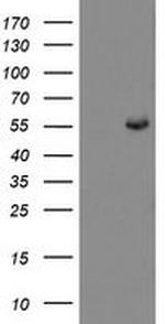 CHN1 Antibody in Western Blot (WB)