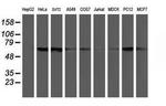 CHN1 Antibody in Western Blot (WB)