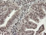 CHN1 Antibody in Immunohistochemistry (Paraffin) (IHC (P))