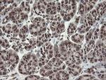 CHN1 Antibody in Immunohistochemistry (Paraffin) (IHC (P))