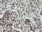 CHN1 Antibody in Immunohistochemistry (Paraffin) (IHC (P))