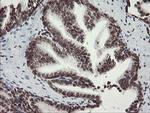 CHN1 Antibody in Immunohistochemistry (Paraffin) (IHC (P))