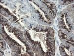 SLA2 Antibody in Immunohistochemistry (Paraffin) (IHC (P))