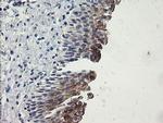 SLA2 Antibody in Immunohistochemistry (Paraffin) (IHC (P))