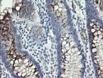 SLA2 Antibody in Immunohistochemistry (Paraffin) (IHC (P))