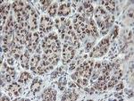 SLA2 Antibody in Immunohistochemistry (Paraffin) (IHC (P))