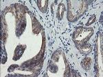 SLA2 Antibody in Immunohistochemistry (Paraffin) (IHC (P))