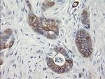 SLA2 Antibody in Immunohistochemistry (Paraffin) (IHC (P))