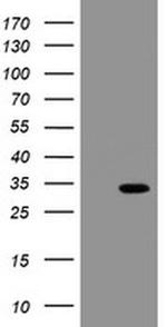 SLA2 Antibody in Western Blot (WB)